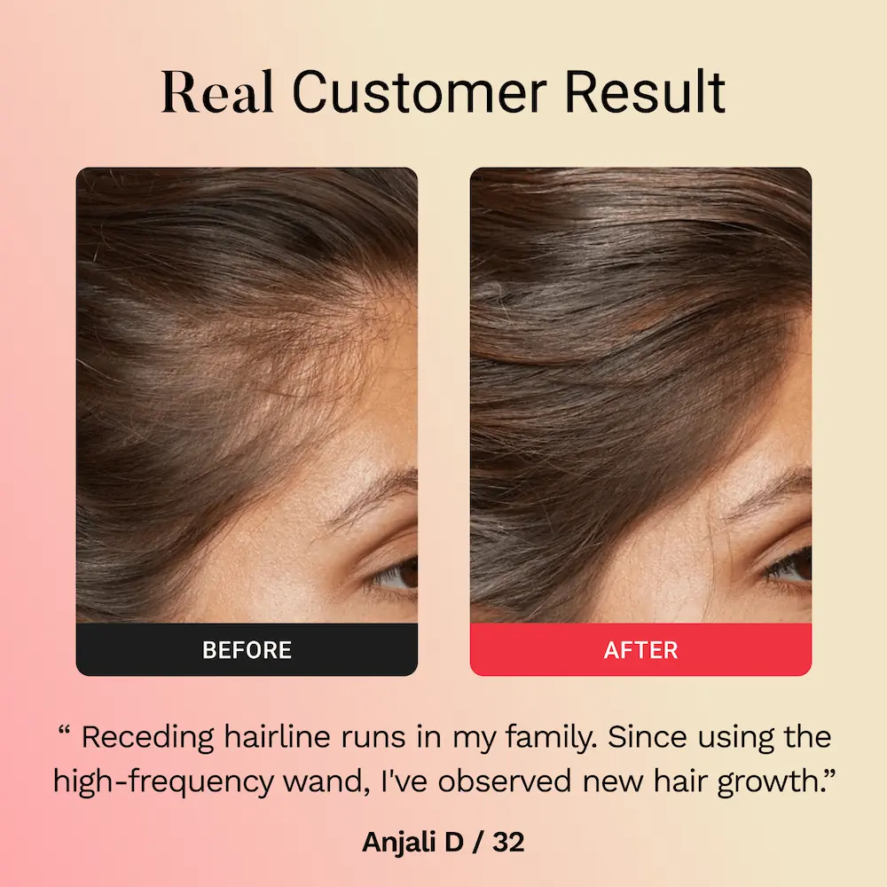 Glamora Hair Regrowth Kit
