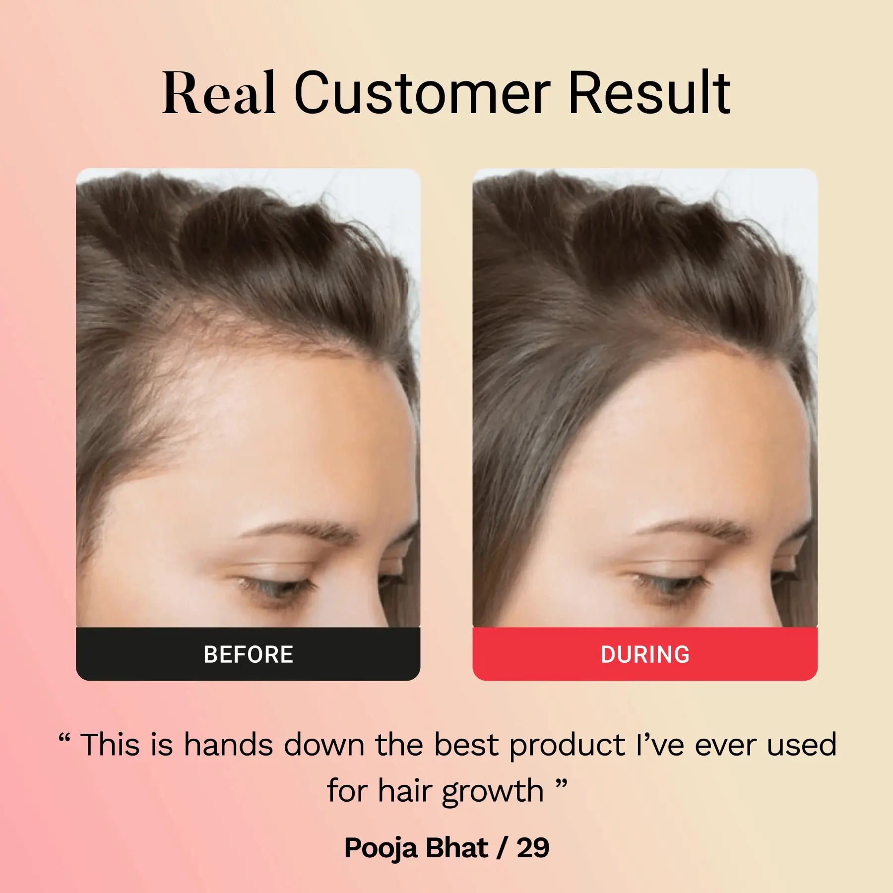 Glamora Hair Regrowth Kit