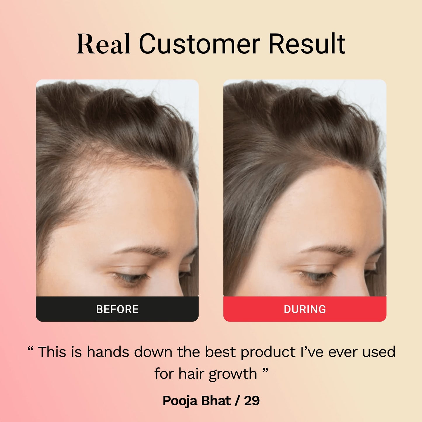 Glamora Hair Regrowth Kit