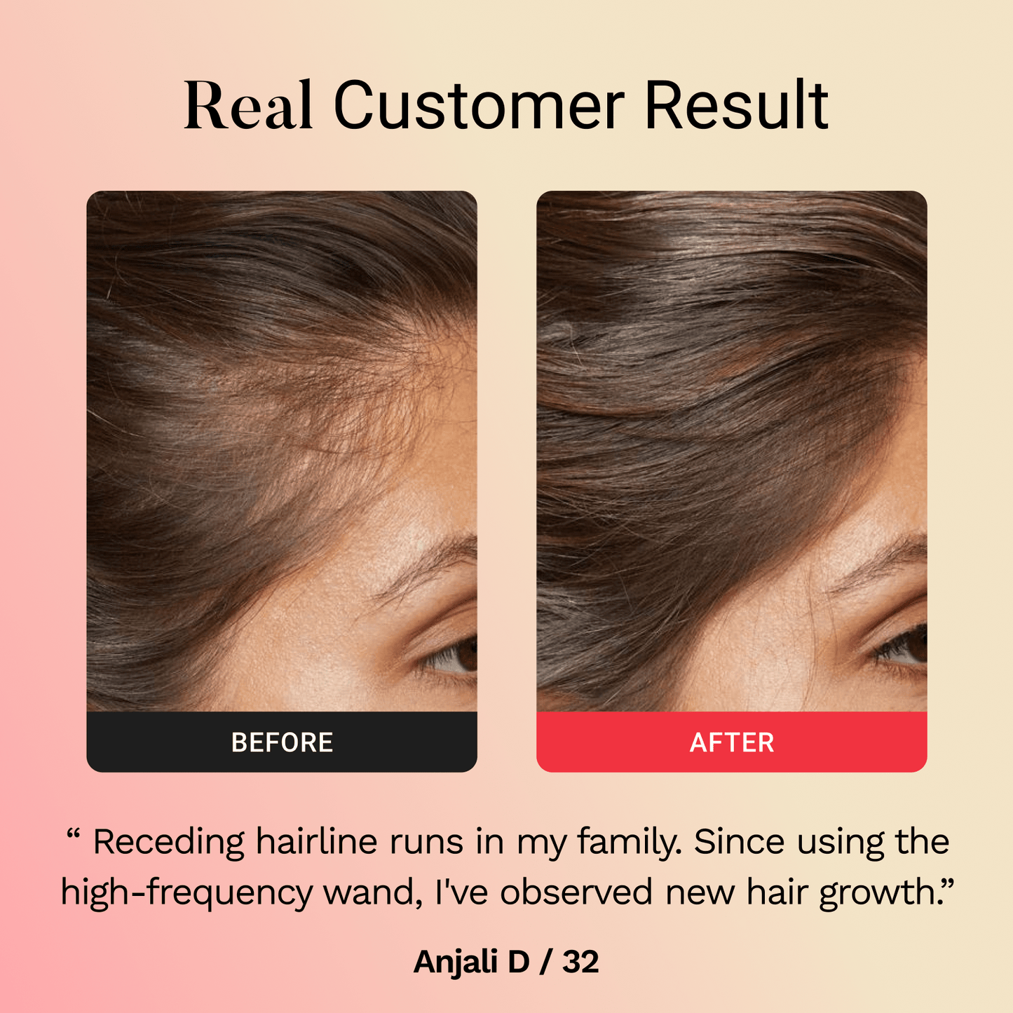 Glamora Hair Regrowth Kit