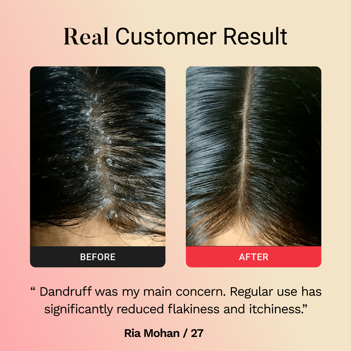 Glamora Hair Regrowth Kit